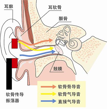 軟骨傳導(dǎo)的機(jī)理